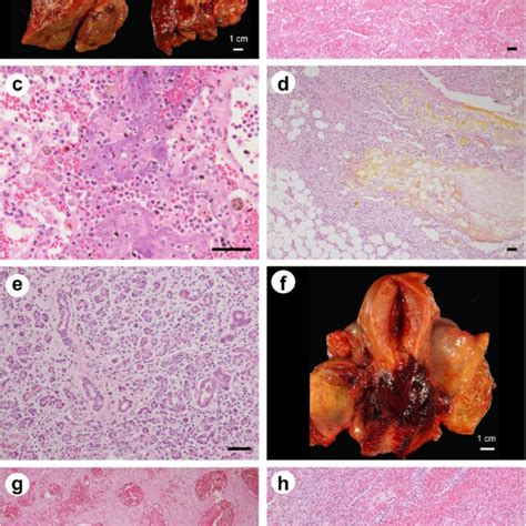 Gross And Histological Findings Of The Other Systemic Organs A F