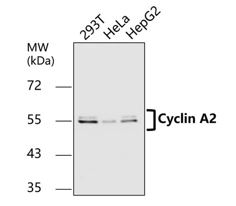 Cell Cycle Marker Antibody Panel IRAP5008 IReal Biotechnology Inc