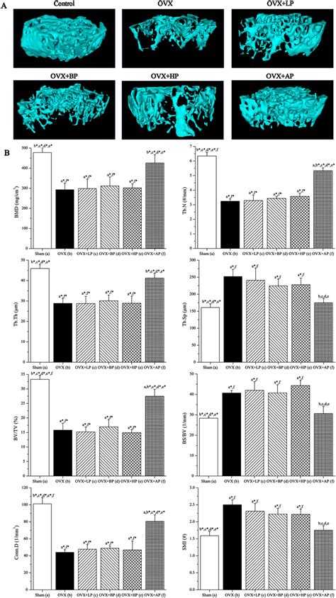 Effects Of Week Emf Exposure On Trabecular Bone Microarchitecture In