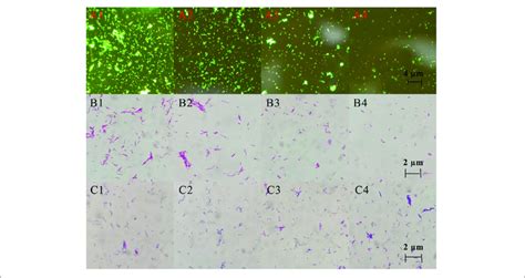 Auramine O Staining Acid Fast Staining And Gram Staining Pictures Download Scientific