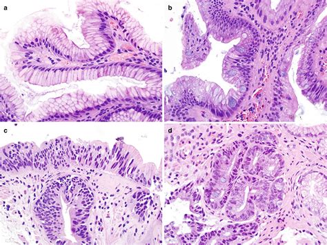 Stomach Rugae Histology