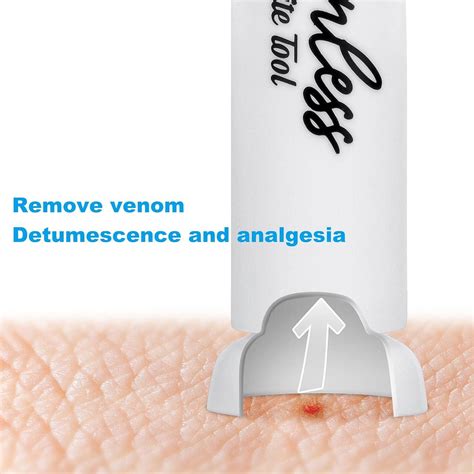 how to gecko itching naturally 8