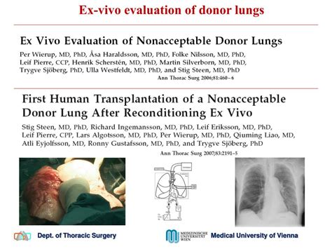 PPT Ex Vivo Lung Perfusion EVLP Clemens Aigner MD Vienna Lung