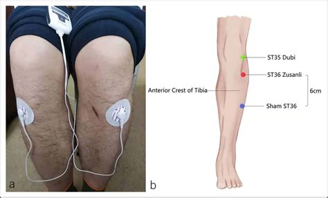 (a) Placement of TEA electrodes at ST36. (b) Location of acupoints for... | Download Scientific ...