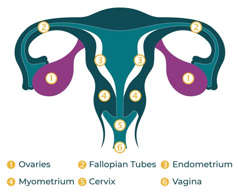 What Is Ovarian Cancer World Ovarian Cancer Coalition