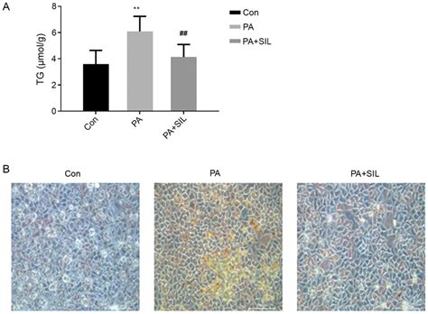 Effects Of Silybin On Lipid Deposition In Hepg2 Cells Cultured With Pa