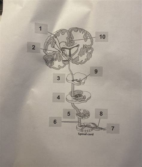 The Anterolateral System Diagram Quizlet