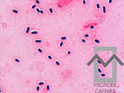 clostridium perfringens colony morphology