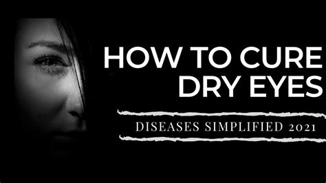 How To Cure Dry Eyes Youtube