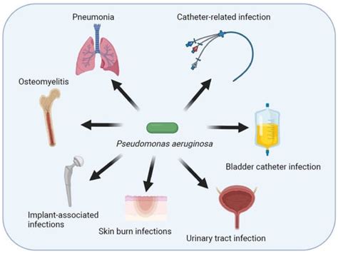 Pathogens Free Full Text Pathogenesis Of The Pseudomonas Aeruginosa