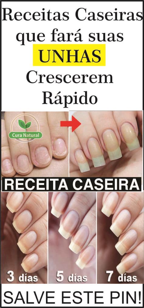 Mar As Receitas Para Acelerar O Crescimento Das Unhas Al M