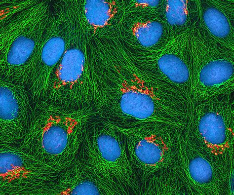 What Is The Difference Between Primary Cell Culture And Cell Line