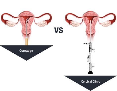 Choisang Clinic | Best Hospitals for Gynecology