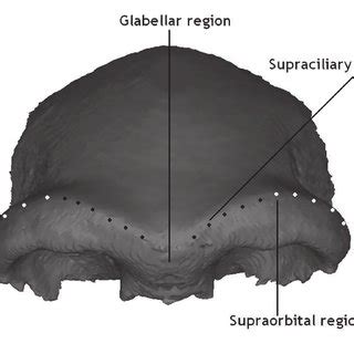 Subregions of the supraorbital torus. | Download Scientific Diagram