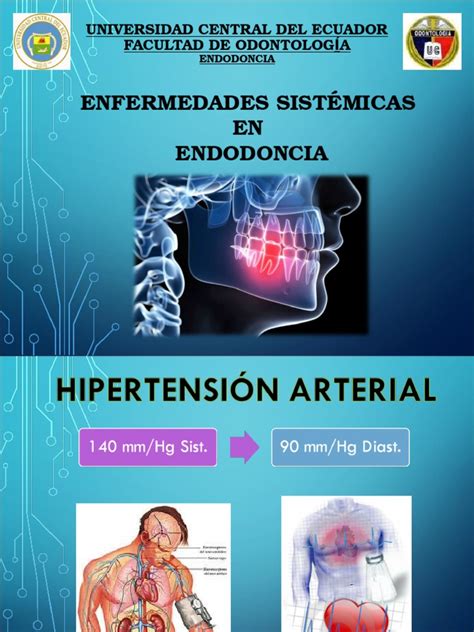 PDF Enfermedades Sistémicas en Endodoncia DOKUMEN TIPS