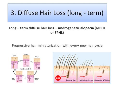 Short Term Vs Permanent Hair Loss And The Best Treatments For Both