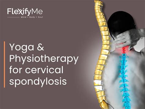 Cervical Spondylosis Treatment With Yoga Physiotherapy