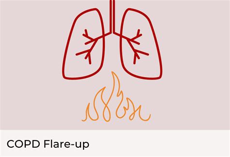 COPD Flare Up: A Painful Lung Condition