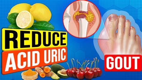 Best Foods That Lower Uric Acid Levels Naturally Youtube