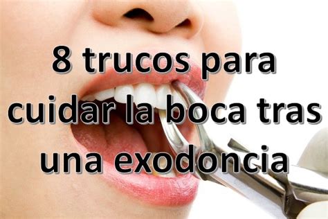 8 Trucos Para Cuidar La Boca Tras Una Exodoncia