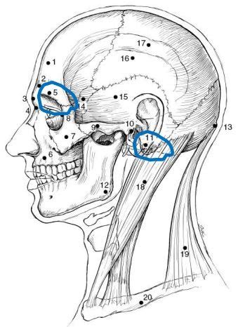 Arrt Boards Prep Anatomy And Physiology Skull Bony Anatomy