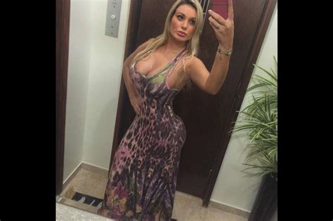 Andressa Urach La Ex Miss Bum Bum Que Sufre Por Un Mal Procedimiento