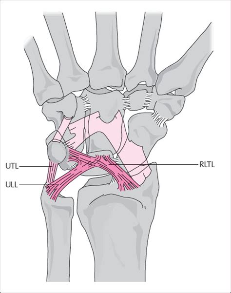 10 Carpal Ligaments | Radiology Key