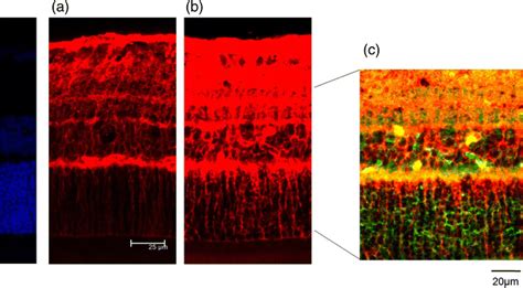 Representative Photomicrographs Of Retina Tissues Stained Download