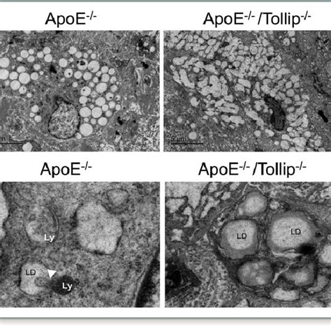 Toll Interacting Protein Tollip Deficiency Promotes Liver Steatosis Download Scientific