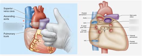 thoracic anatomy: cardiovascular - Pericardial sinuses and ligaments🫀 Diagram | Quizlet