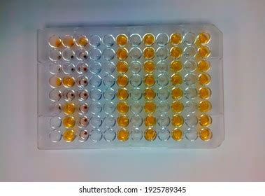 Hemagglutination Assay T Pallidum Antibodies Tpha Stock Photo 1925789345 | Shutterstock