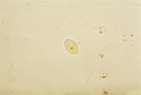 Free Picture Giardia Lamblia Parasite Iodine Stain