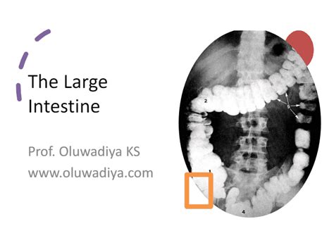 Crossword Large Intestine Prof KS Oluwadiya Online