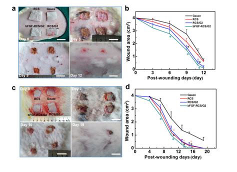 The Wound Closure Of Partial Thickness A And Full Thickness C