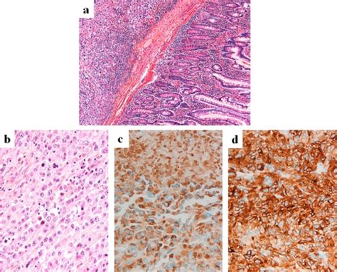 Photomicrograph Of A Histological Section Of The Resected Duodenal Download Scientific Diagram