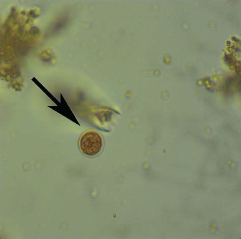 Fecal Wbc Prep With Stain