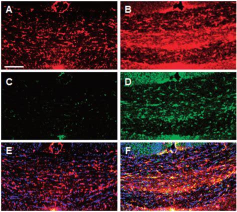 Confocal Microscopy Images Of Glial Fibrillary Acidic Protein Gfap