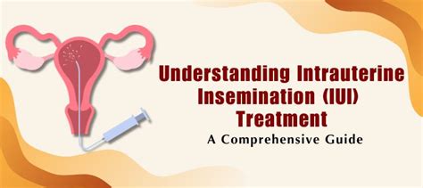 Understanding Intrauterine Insemination Iui A Comprehensive Guide