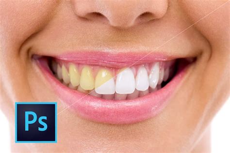 Clarear Dentes No Photoshop Tutorial Completo Passo A Passo