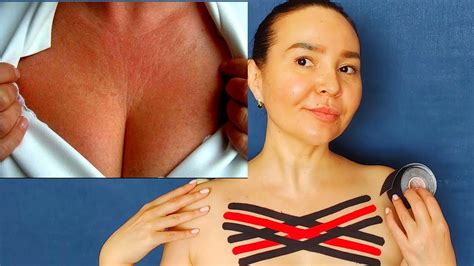 Chest Wrinkles How To Remove And Prevent With Kinesio Taping Youtube