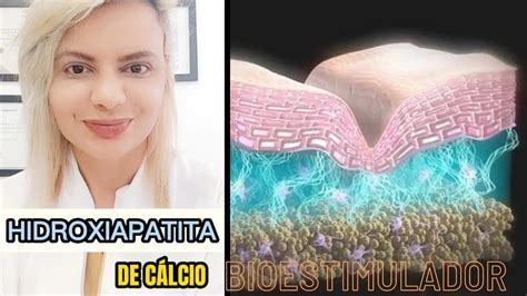 Como A Hidroxiapatita De C Lcio Estimula Col Geno Youtube