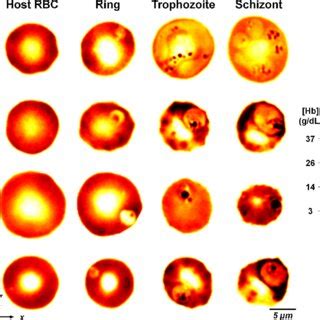 D Refractive Index Maps Of Uninfected And Parasitized Ring