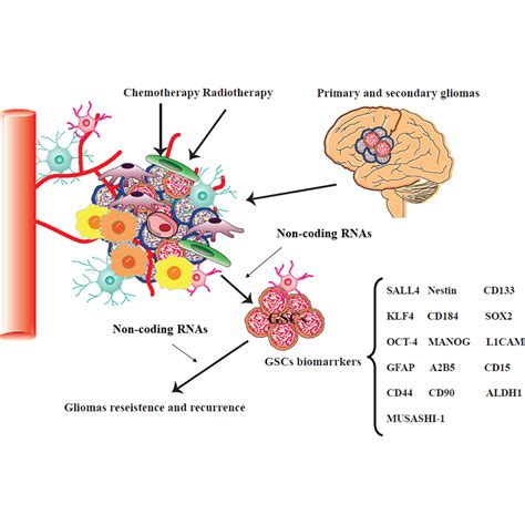 Non Coding RNAs And Glioma Focus On Cancer Stem Cells Science News