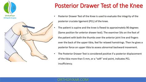 Posterior Drawer Test Of The Knee OrthoFixar 2023, 57% OFF