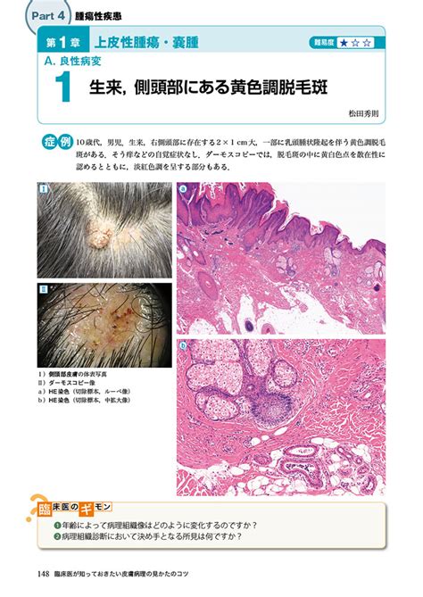 病理像＋臨床写真で一目でわかる！ 臨床医が知っておきたい皮膚病理の見かたのコツ 羊土社