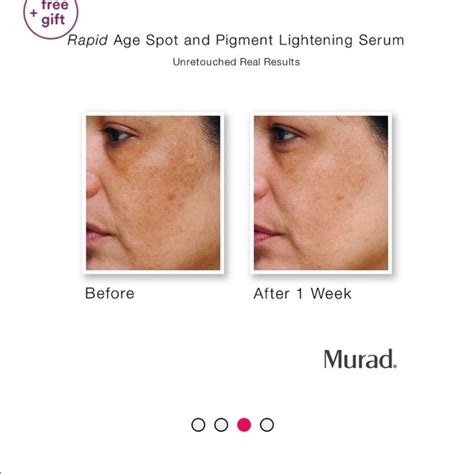 Murad Skincare Murad Rapid Age Spot Pigment Lightening Serum Oz