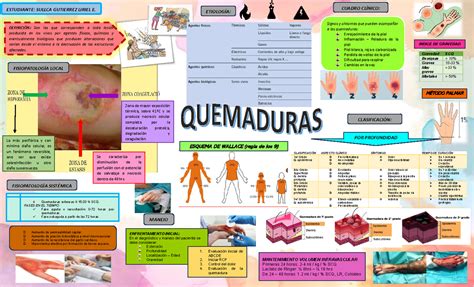 Infografia De Quemaduras Clasificaci N Aspecto Cl Nico S Ntomas