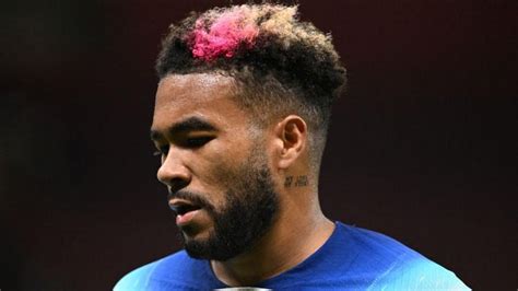 soccer englands james   world cup due  knee injury euronews