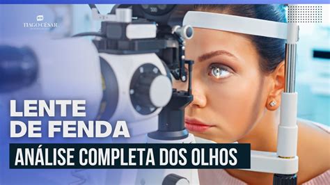 Lente De Fenda An Lise Completa Dos Olhos Dr Tiago C Sar Youtube