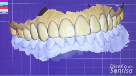 Impresión de piezas dentales con Sistema CAD CAM YouTube